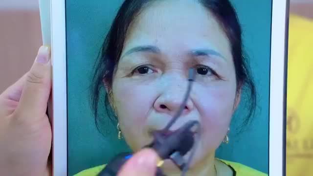 Sụp mí tuổi trung niên che khuất tầm nhìn phải khắc phục như thế nào? Mời cả nhà cũng theo dõi