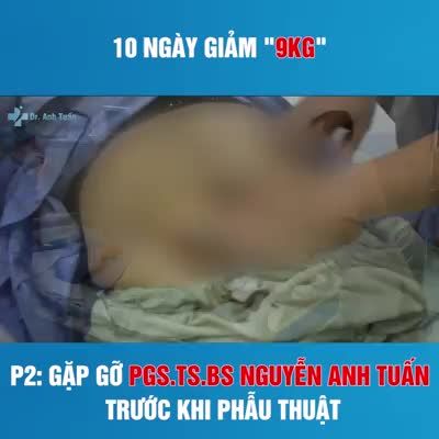 Kiểm tra trước khi thực hiện phương pháp giảm béo thu nhỏ dạ dày
