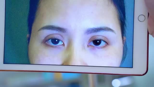 Dr.Hải Lê top 1 sửa mí lỗi hỏng mọi cấp độ thành công ngoài sự mong đợi