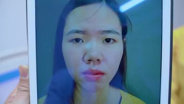 Mắt 1 mí, sụp mí u buồn cắt mí có cải thiện được không? Mời quý khách hàng cùng đón xem