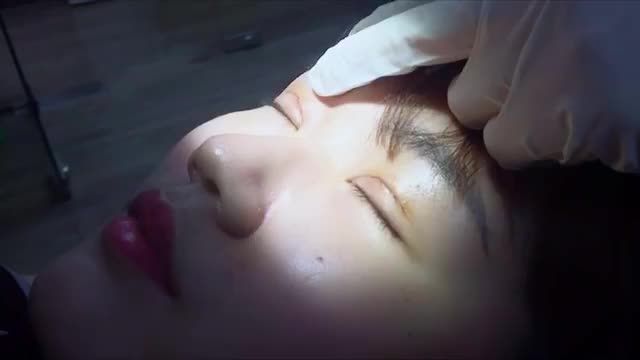 Quy trình cắt chỉ mí mắt sau 7 ngày thực hiện Mời cả nhà cùng đón xem!