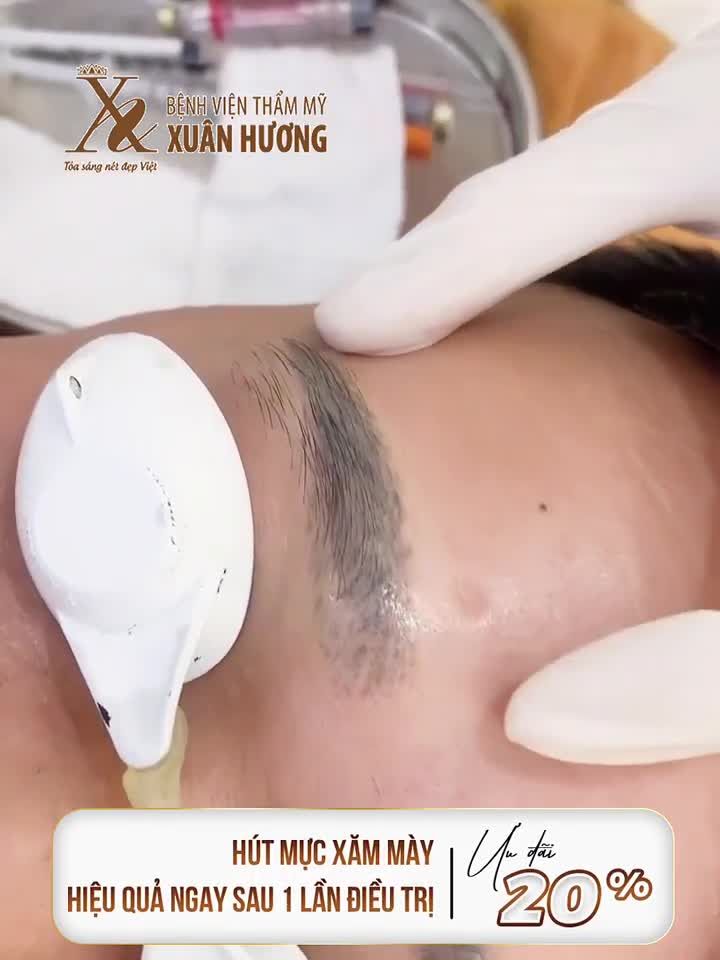 MỰC XĂM MÀY LÂU NĂM ĐƯỢC XÓA SẠCH HIỆU QUẢ CHỈ TRONG 15 PHÚT
