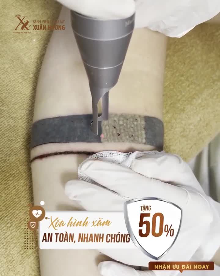 GIẢI PHÁP LOẠI BỎ MỰC XĂM HIỆU QUẢ MÀ KHÔNG XÂM LẤN LÀN DA