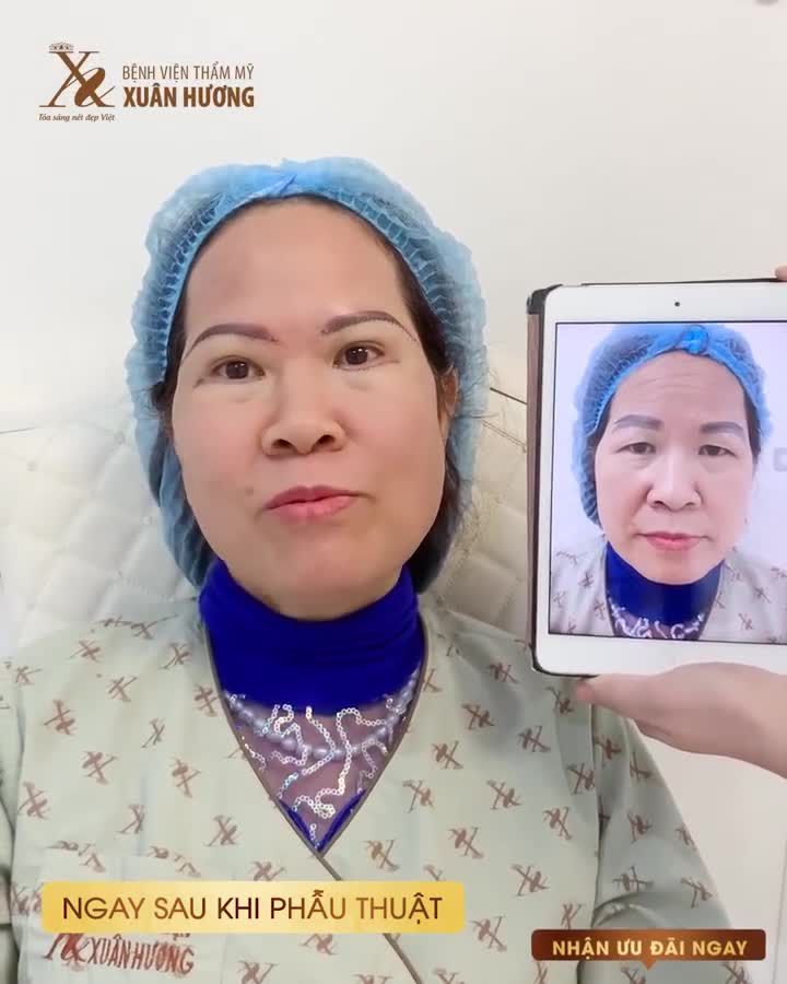 ĐẸP NGAY TRONG 1 LẦN: KHUÔN MẮT HẾT DA CHÙNG + DÁNG MÀY MỚI THỜI THƯỢNG
