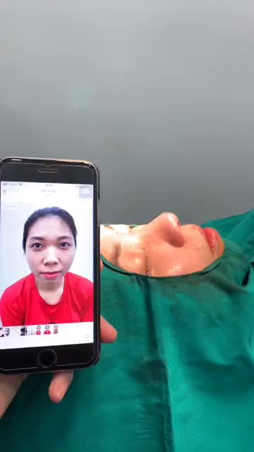 Ngay sau khi nâng mũi Sline