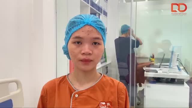 Bạn gái trẻ thực hiện cắt mí Elite Eyes tại Thẩm mỹ DrD để “biến hình” đôi mắt 1 mí của mình.