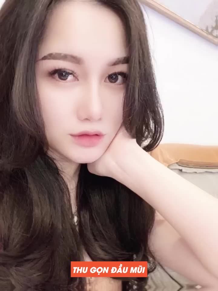 Có một điều nàng cần đồng ý với DrD đó là: Kỹ thuật nâng mũi Perfect Dform "đỉnh của chóp"