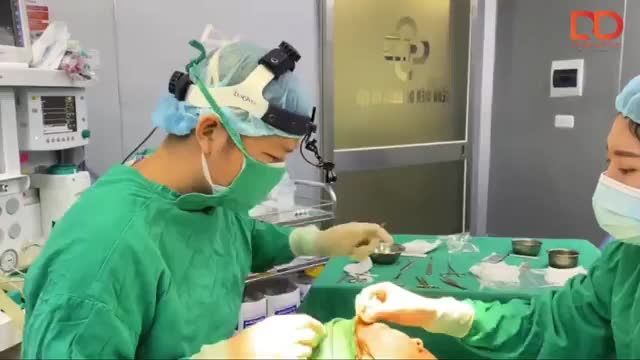 Độn thái dương - dịch vụ được lựa chọn tương đối nhiều tại DrD.