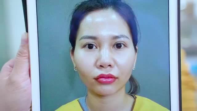 Dr.Hải Lê số 1 sửa mí - Bạn gặp tình trạng mí lỗi hỏng hãy đến Dr.Hải Lê bạn trao niềm tin - Hải Lê sẽ trao cho bạn sự tự tin