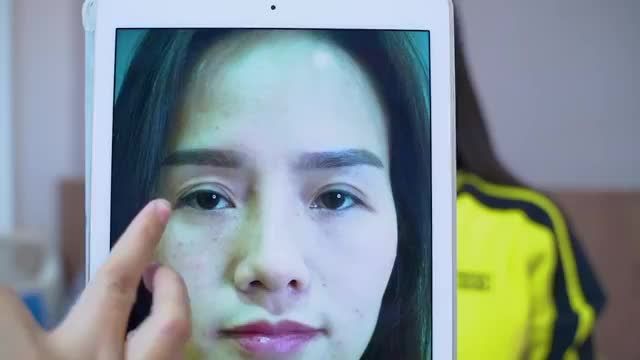 Dr.Hải Lê Top 1 cắt mí sẽ mang đến cho bạn một đôi mắt như thế nào? Mời bạn cùng đón xem thông qua video này để có cảm nhận nhé