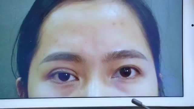 Dr.Hải Lê Top 1 sửa mí Chỉ cần bạn trao niềm tin Dr.Hải Lê sẽ trao cho bạn sự tự tin