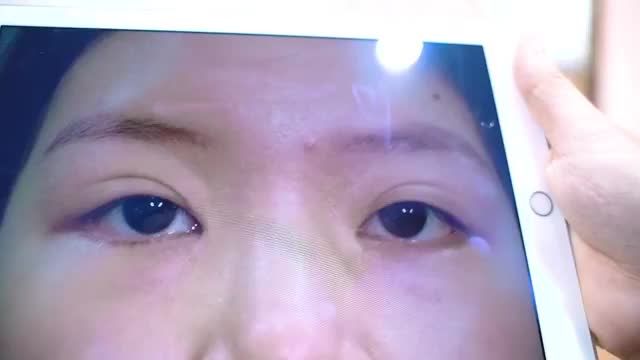 Hãy trao cho Dr.Hải Lê niềm tin Hải Lê sẽ trao cho bạn sự tự tin Đừng để đôi mắt lỗi hỏng khiến bạn tự ti hãy để đôi mắt giúp bạn tỏa sáng
