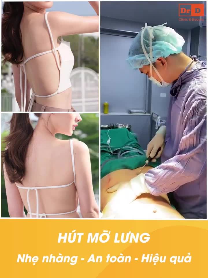 Hút mỡ lưng - Nhẹ nhàng - An toàn - Hiệu quả.