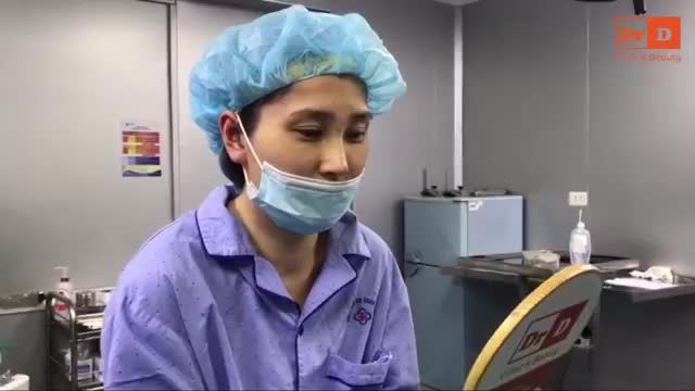 Kết quả ca mũi Perfect Dform ngay sau khi phẫu thuật: sống mũi cao, thẳng, cân đối, đầu mũi được đẩy cao, kéo dài, cánh mũi nhỏ nhắn, lỗ mũi hình hạt chanh tinh tế.