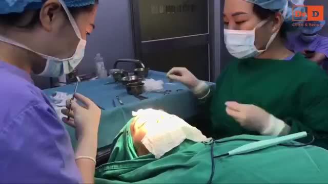 Khách hàng trung tuổi gặp phải tình trạng thừa da mí trên, mí dưới, được chỉ định thực hiện combo: cắt mí trên, mí dưới Elite Eyes và nâng cung mày.