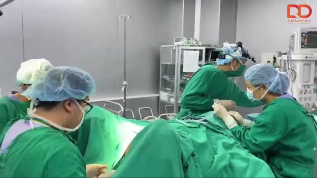 Nâng mũi Perfect Dform + Thẩm mỹ tầng sinh môn.