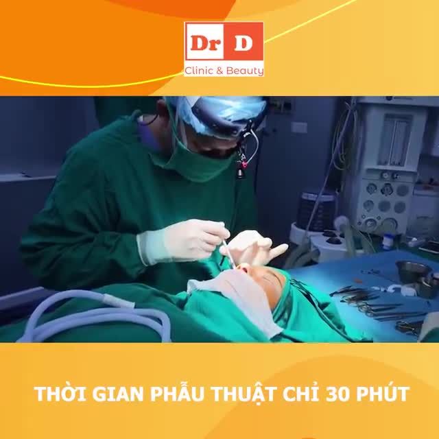 Nâng mũi Sline Surgiform - Tạo điểm nhấn khuôn mặt, tăng thêm nét rạng ngời.