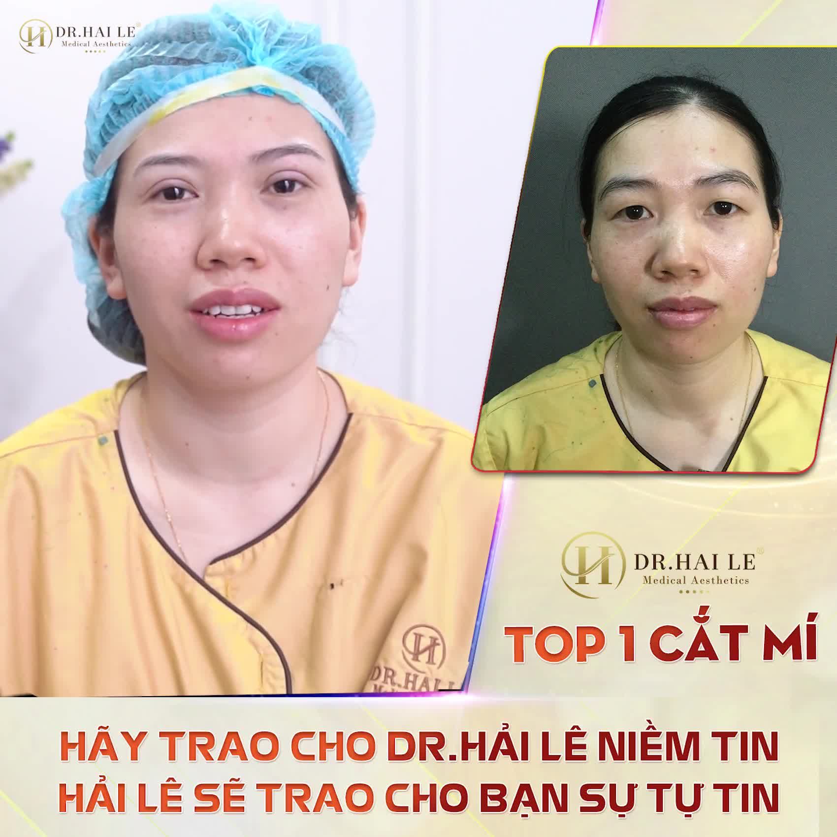 100% tới 100% có quà Cắt mí chỉ từ 6TR5 trong khi giá gốc của nó từ 13-35TR. SALE CỰC SỐC!.