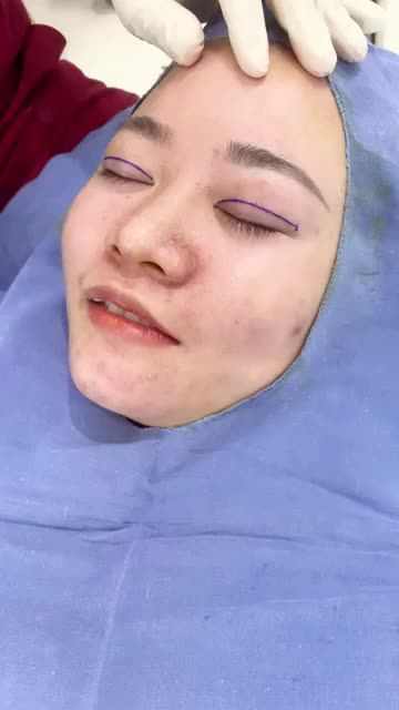 Cô gái xinh duyên với chiếc răng khểnh nhưng luôn mong muốn sở hữu đôi mắt 2 mí to rõ trẻ trung