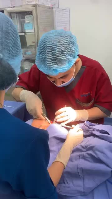 Quy trình thực hiện Cắt mí Plasma Hàn Quốc và xóa rãnh lệ