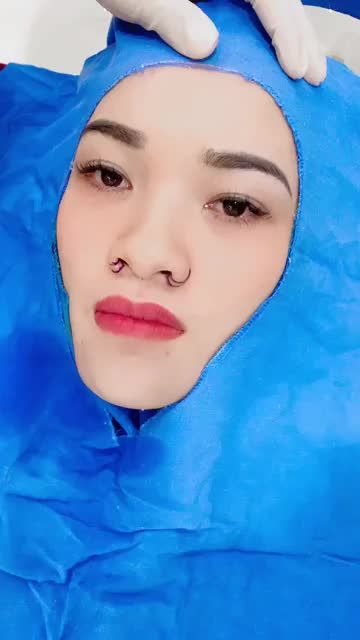 Bác sĩ Kangnam phân tích quá trình phẫu thuật combo tạo hình môi và thu nhỏ cánh mũi