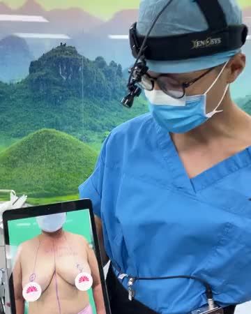 GIẢI PHÁP NÀO CHO TÌNH TRẠNG V1 PHÌ ĐẠI - SA TRỄ ĐỘ 4?