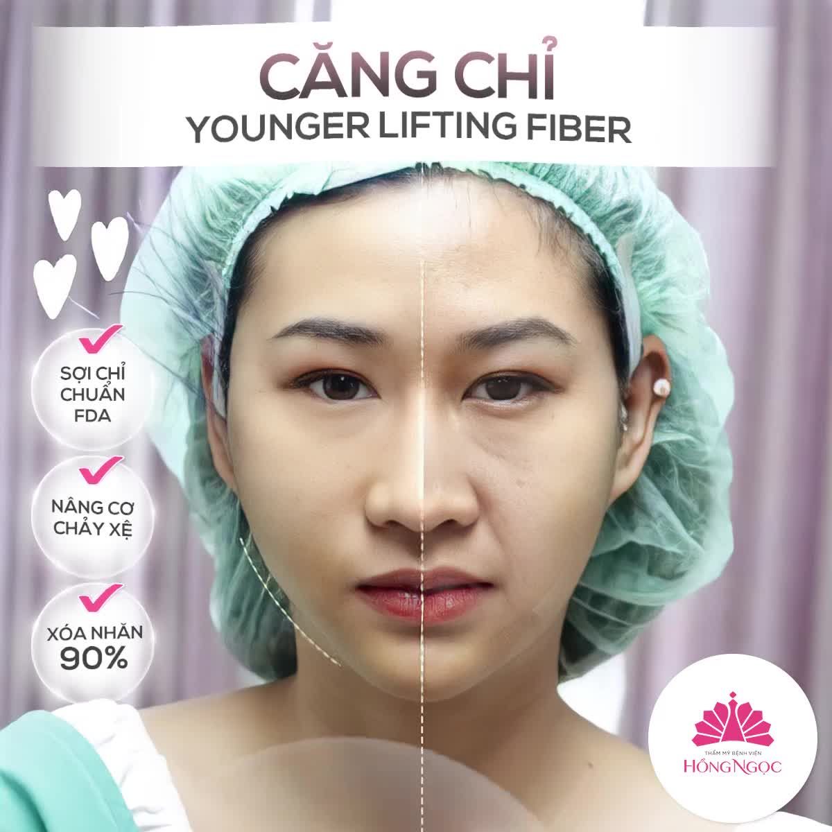 ''ĐỨNG HÌNH'' TRƯỚC SỰ KHÁC BIỆT TRÊN 2 NỬA GƯƠNG MẶT SAU KHI CĂNG CHỈ YLF