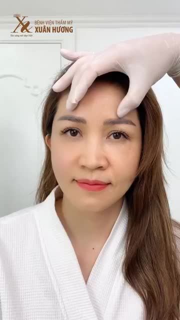 BẤT NGỜ VỚI KẾT QUẢ SAU 30 PHÚT NÂNG CƠ NỬA KHUÔN MẶT CỦA HOA HẬU NGÔ THU TRANG