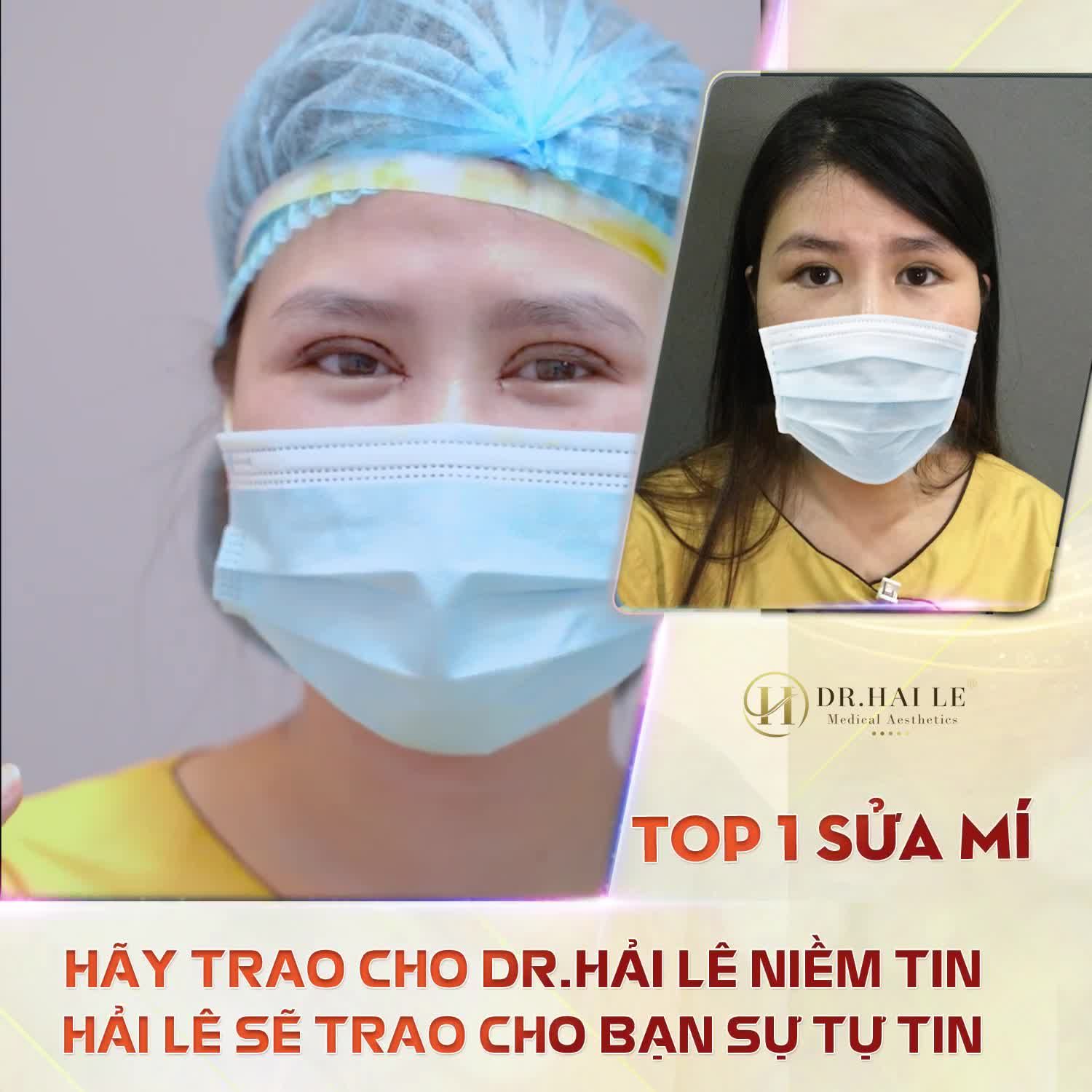 SỬA MÍ DEEP TECH20 - DR.HẢI LÊ CAM KẾT LUÔN LÀM KHÁCH HÀNG HÀI LÒNG.!!