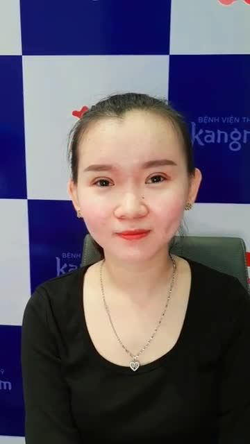 Thăng hạng nhan sắc sau 1 tháng cắt mí