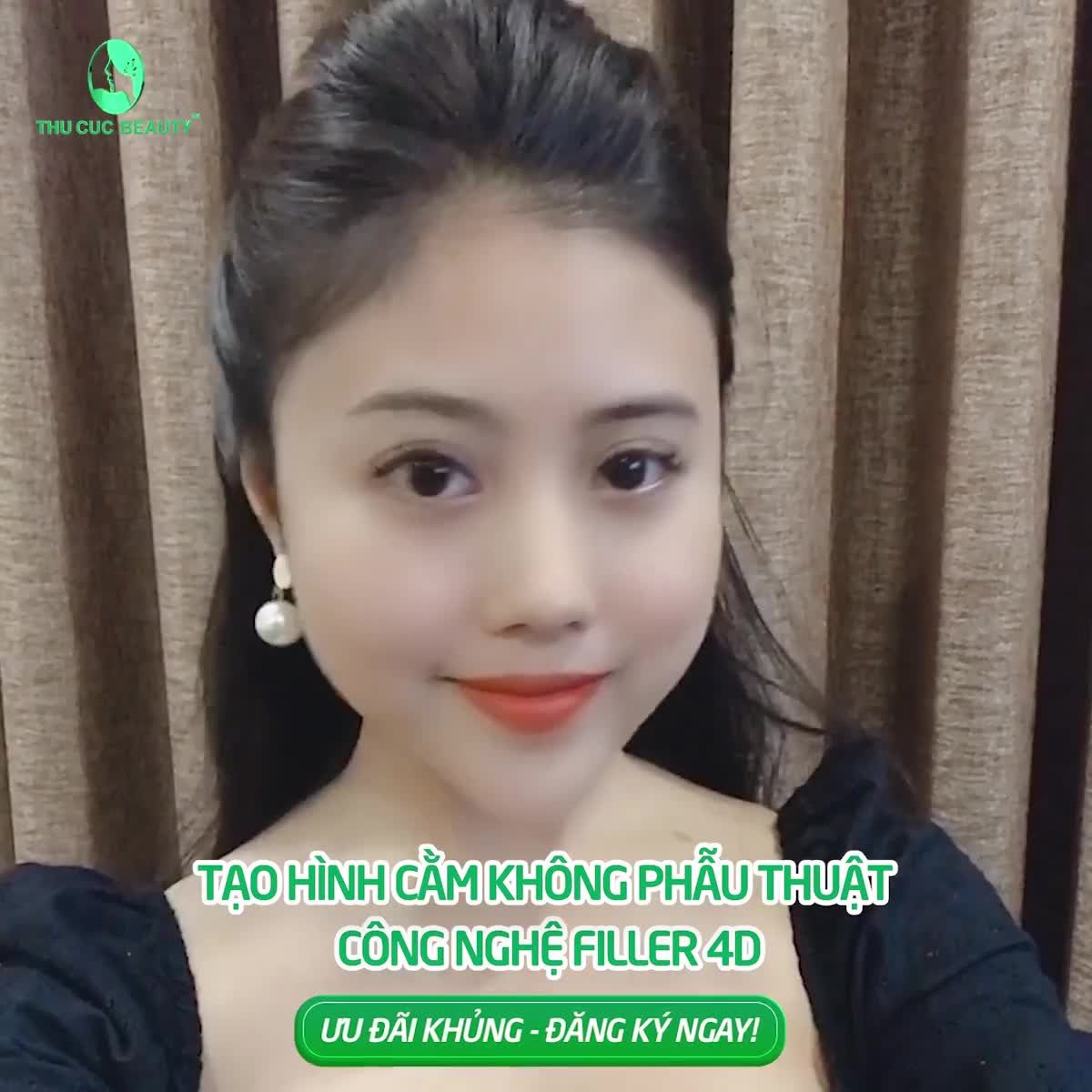 CẰM V-LINE THON GỌN - ĐẸP TRỌN MỌI GÓC NHÌN