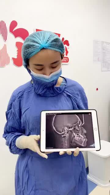 Móm - Tình trạng hàm mặt phổ biến, không chỉ ảnh hưởng tới ngoại hình