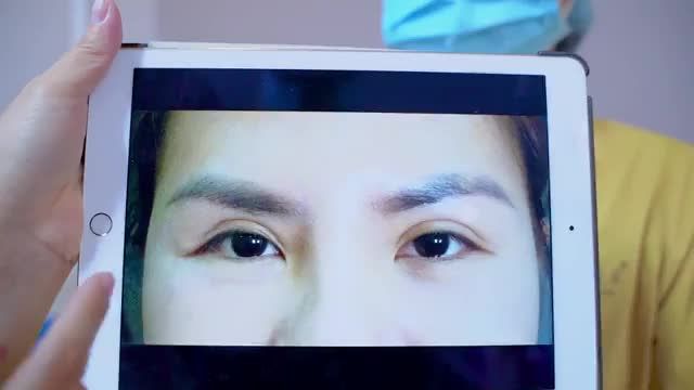 Mí hỏng tới đâu Hải Lê lo tới đó, khẳng định không có tình trạng mí lỗi hỏng từ nặng đến nhẹ mà đội ngũ Y Bác sĩ tại Dr.Hải Lê không chưa lành được