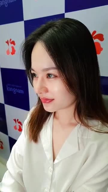 Combo thần thánh Cắt mí + Nâng mũi Xoay góc nào cũng đẹp