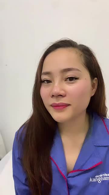 Kết quả nâng mũi tại BVTM KANGNAM
