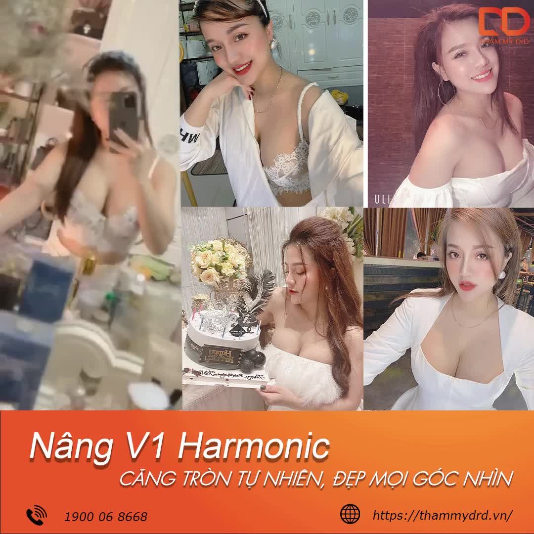TỪ "LÉP KẸP" ĐẾN "CĂNG TRÒN"