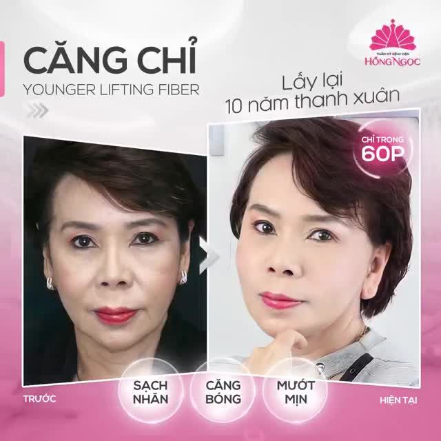 U60 ''LỘI NGƯỢC DÒNG THANH XUÂN'' SAU 60P CĂNG CHỈ YOUNGER LIFTING FIBER