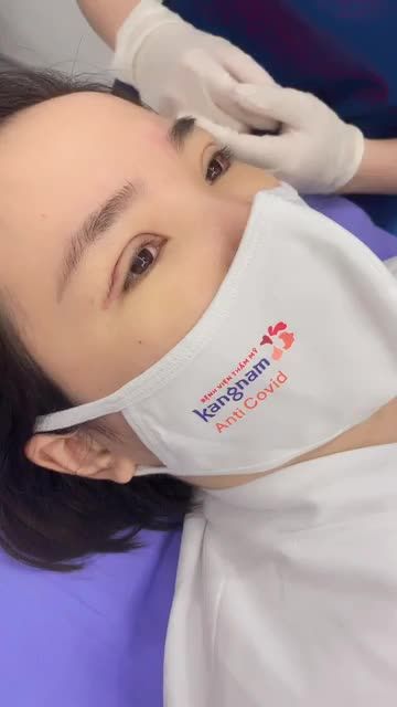 Cận cảnh cắt chỉ mí  Đẹp không cả nhà