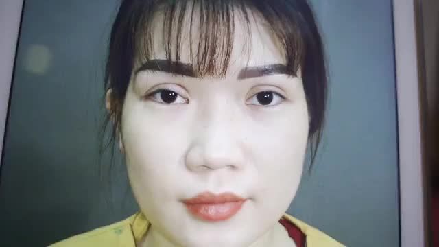 Đừng để mí hỏng khiến bạn tự ti hãy để đôi mắt đẹp giúp bạn tự tin