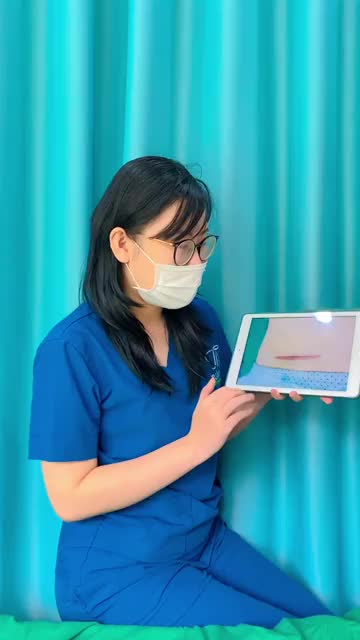 PHẪU THUẬT SỬA SẸO SAU SINH