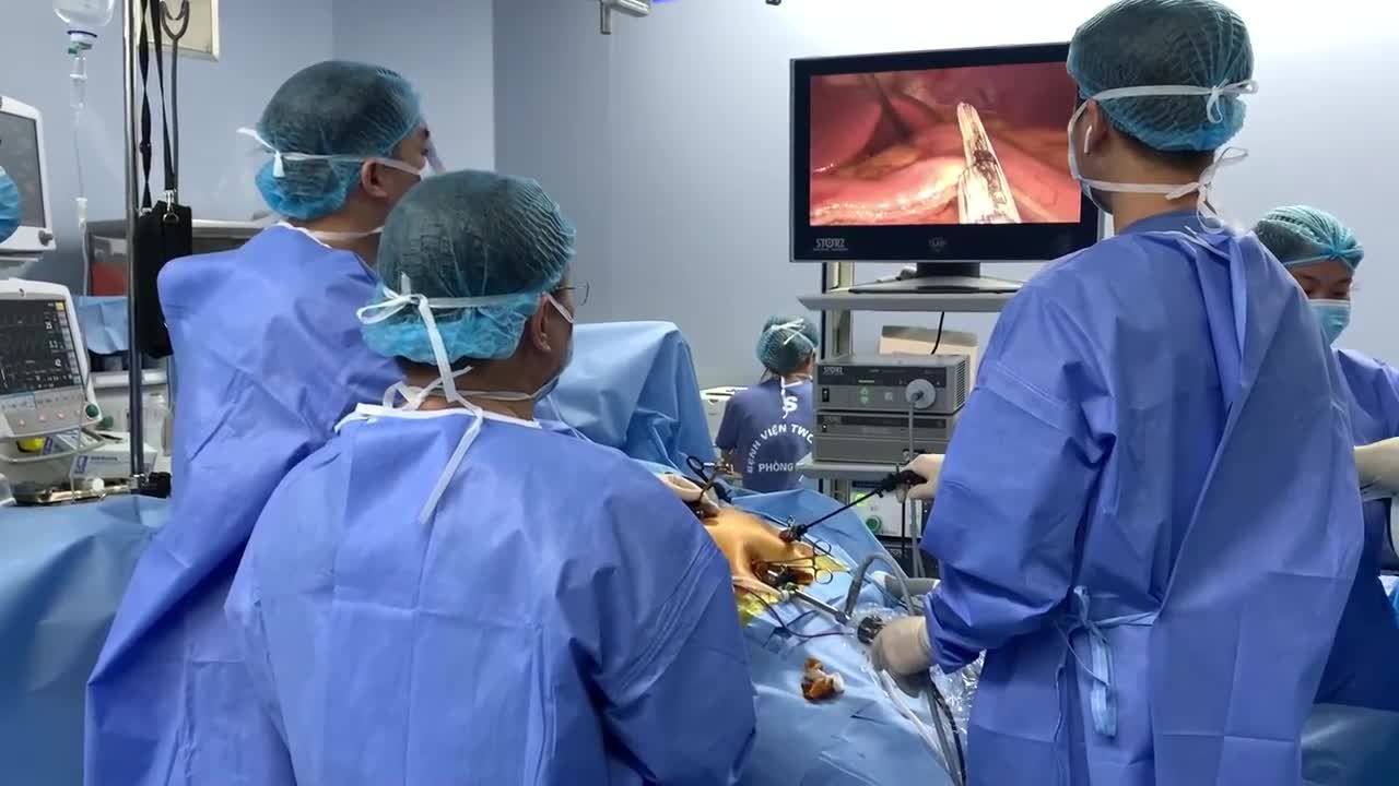 Ưu điểm của Phẫu thuật Nội soi