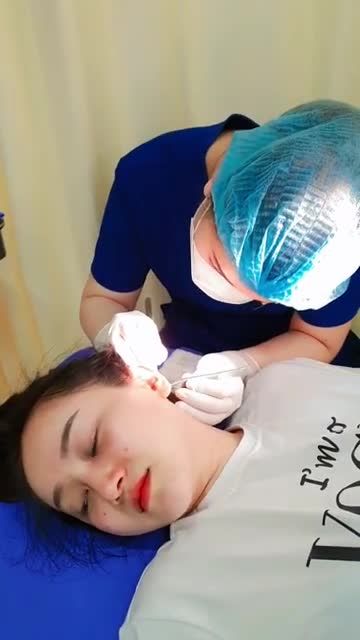 Kết quả nâng mũi sline 4d tại bệnh viện thẩm mỹ kangnam 666