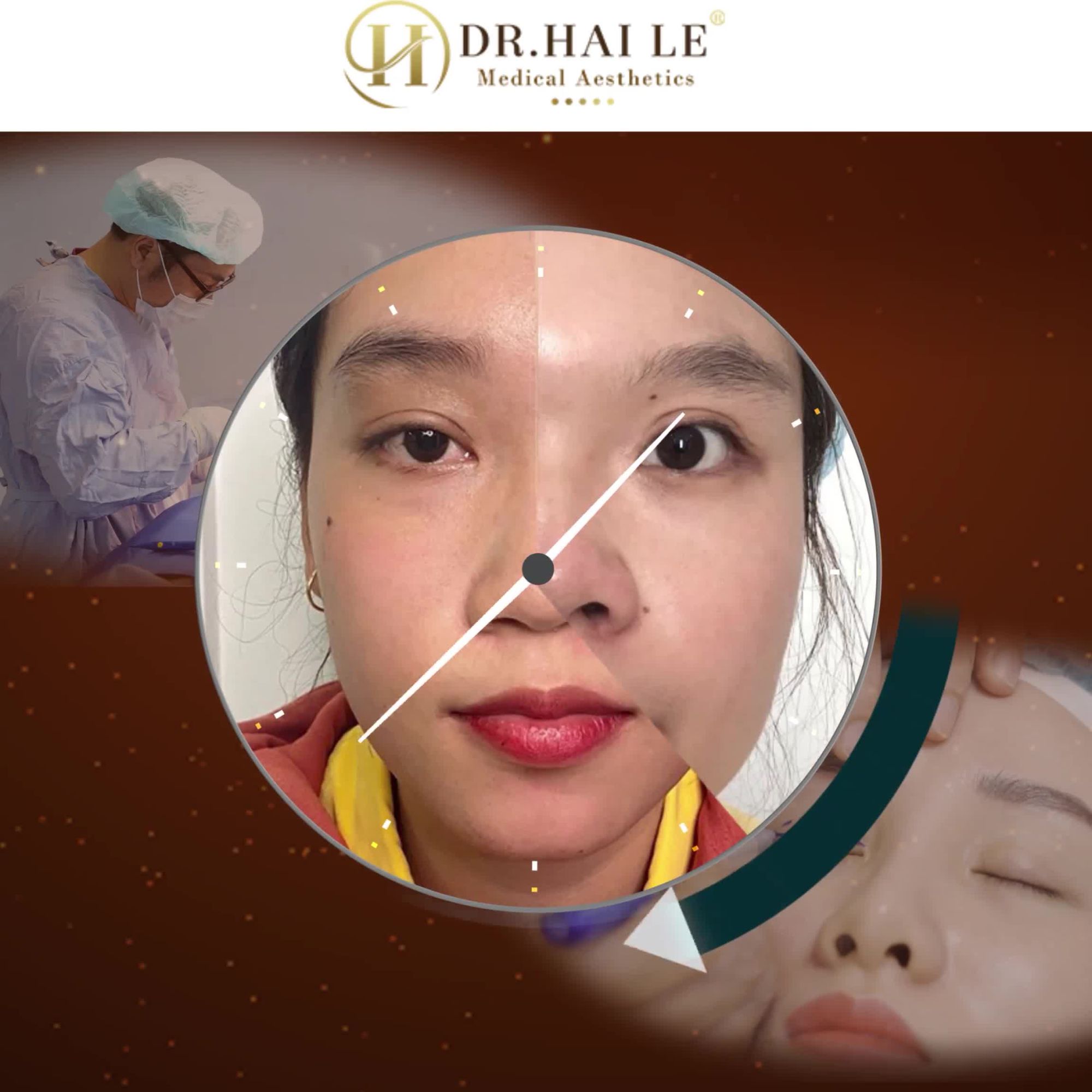Khi khách hàng review về cắt mí nhà Dr.Hải Lê "Quá ưng"; "vô cùng hài lòng"; "ai cũng khen"