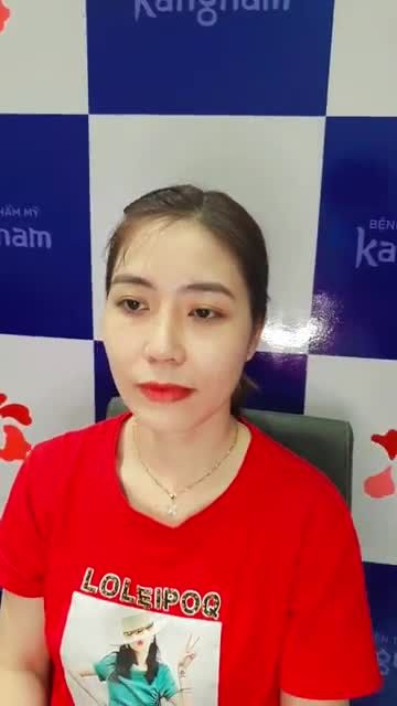 Thay đổi ngoạn mục nhờ công nghệ nâng mũi sline 4d tại BVTM Kangnam