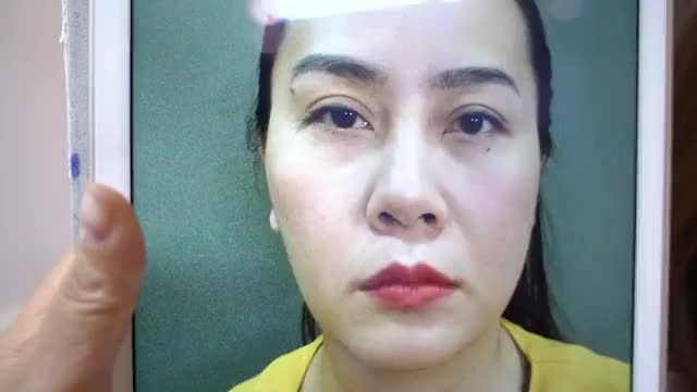 Hãy là người tiếp theo sở hữu công nghệ thẩm mỹ mắt độc quyền tại nhà Dr. Hải Lê. Cắt một lần - Đẹp trọn đời