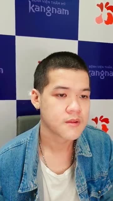 Chỉnh hàm móm - hóa "Hot boy" là có thật Cận cảnh nhan sắc hài hòa, tự nhiên sau 20 ngày chỉnh móm