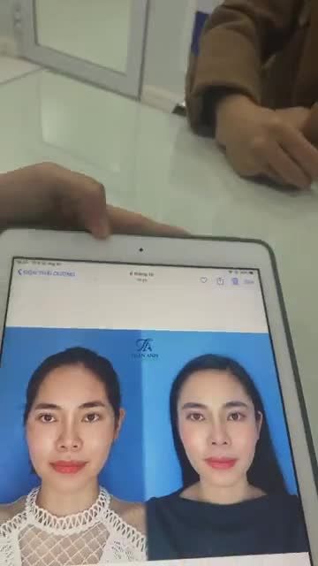 CẢM XÚC CỦA KHÁCH HÀNG SAU 6 THÁNG SỬ DỤNG ĐỘN THÁI DƯƠNG