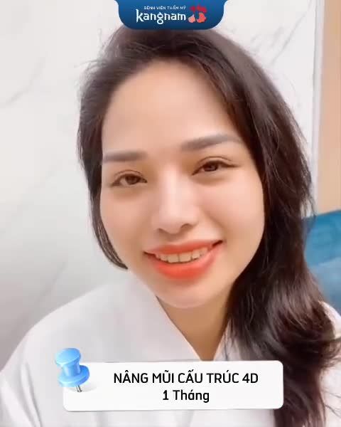 Ngất ngây dáng mũi cấu trúc mới 1 tháng cả nhà ạ