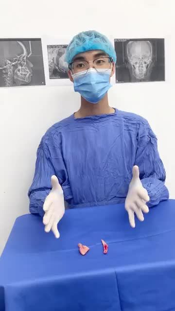 Bác sĩ phân tích phẫu thuật Gọt hàm Vline Hàn Quốc
