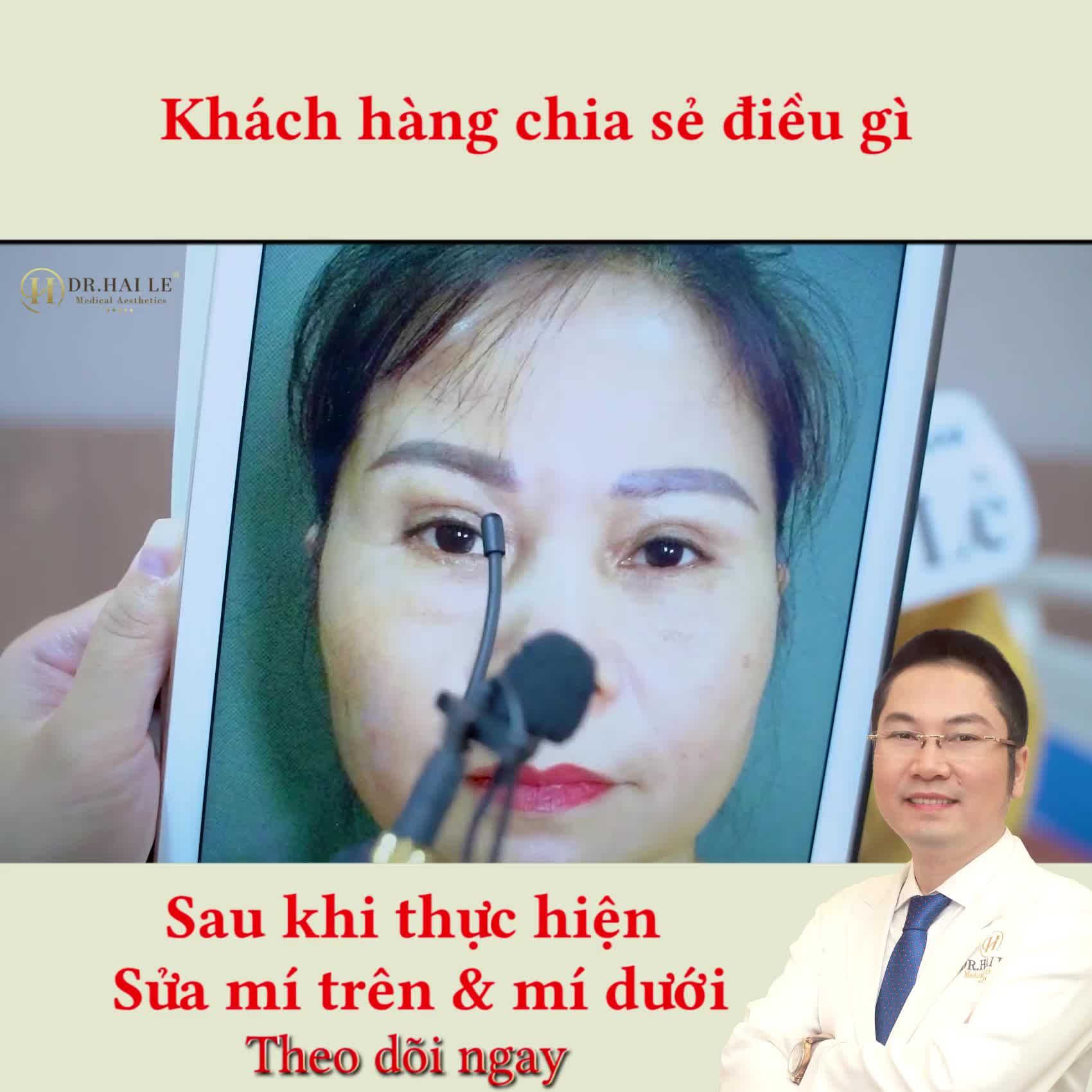Dr.Hải Lê - Top 1 sửa mí Combo sửa mí trên+ sửa mí dưới